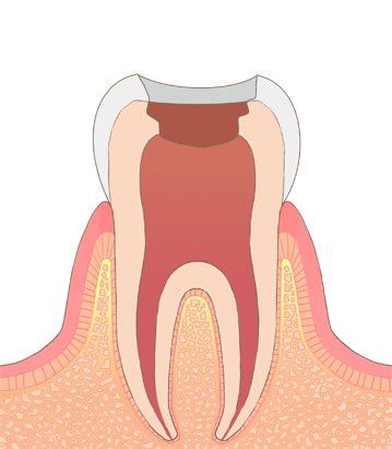 枚方で根管治療ならしおみ歯科クリニック1